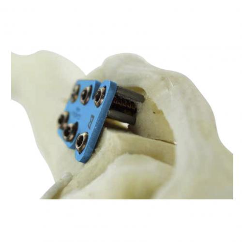 Rapid Luxation - Patella luxation