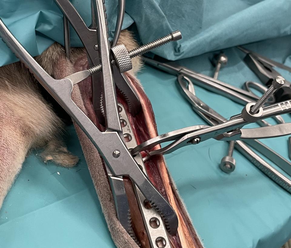 🦴 Fracture Management