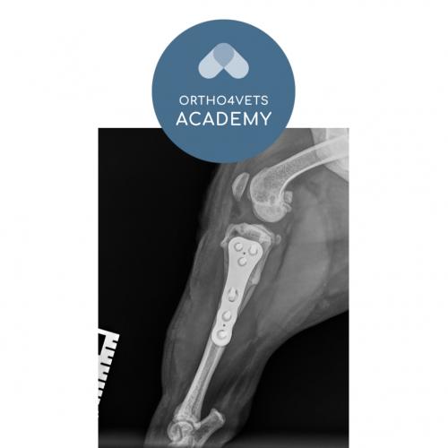 CTWO - Closing Wedge Tibia Osteotomy 